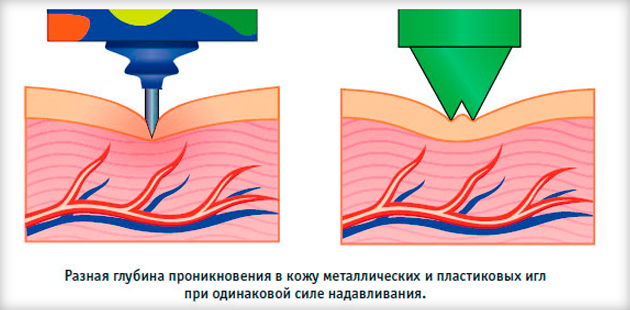 який ефект робить аплікатор Кузнєцова