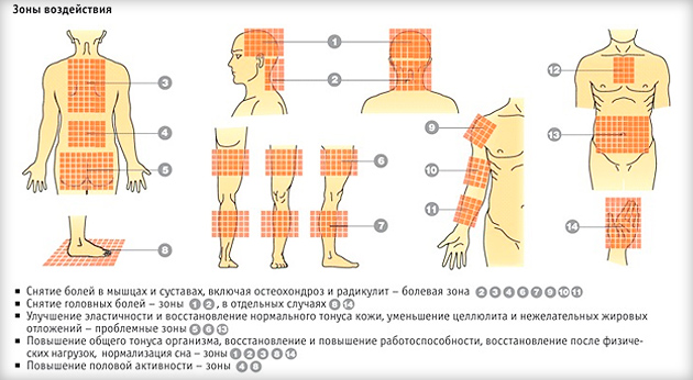 куди ставити аплікатор: зони постановки