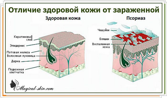 Здорова і хвора шкіра