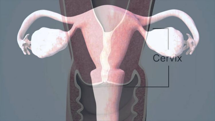 Як проводять цервікометрію при вагітності?