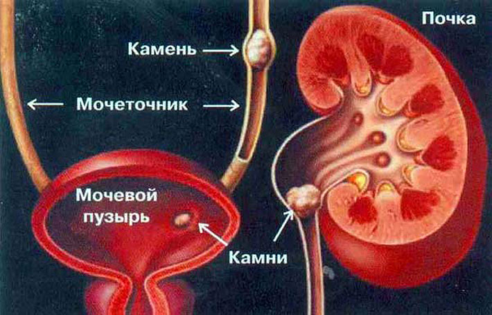 Як вимірюють обсяг сечового міхура?